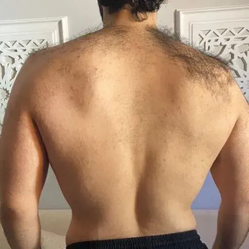 After transformation