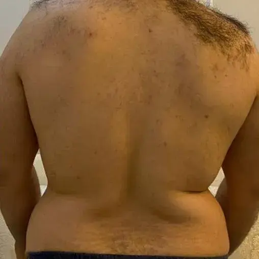 Before transformation