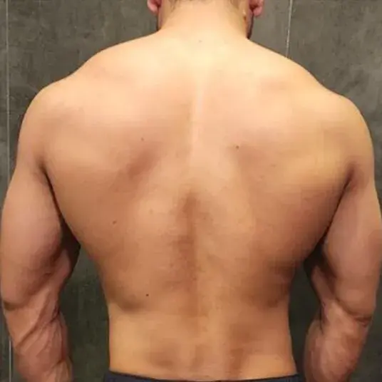 After transformation