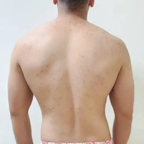 Before transformation