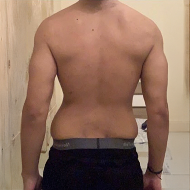 Before transformation