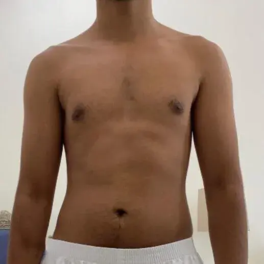 Before transformation