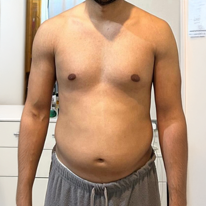 Before transformation