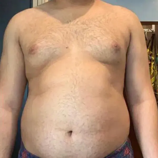 Before transformation