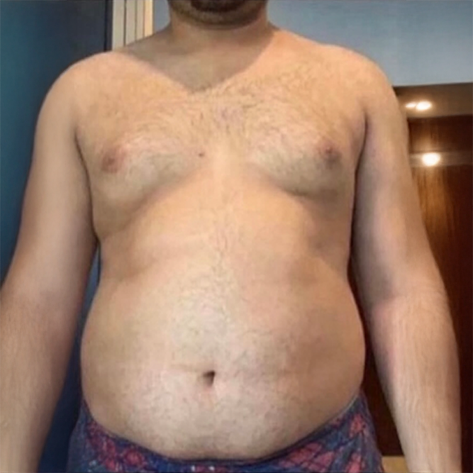 Before transformation