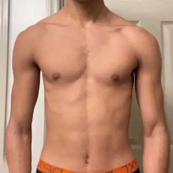 Before transformation