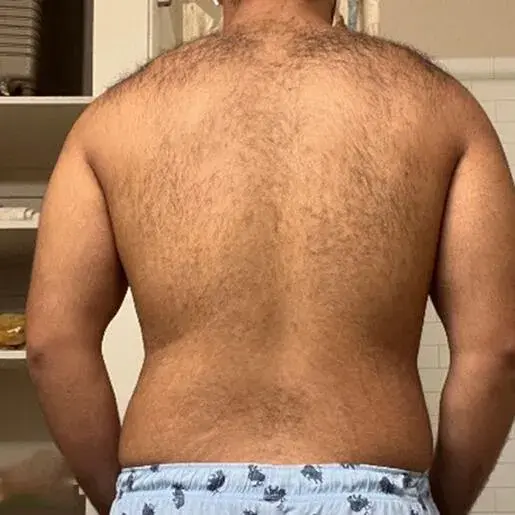 After transformation