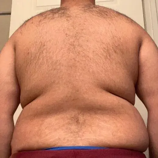 Before transformation