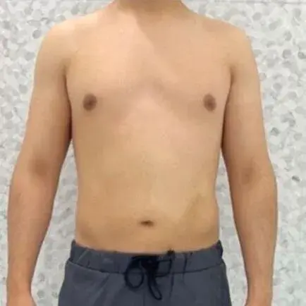 Before transformation