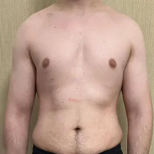 After transformation