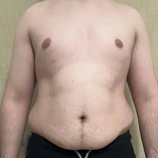Before transformation