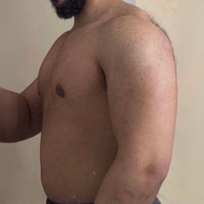 Before transformation