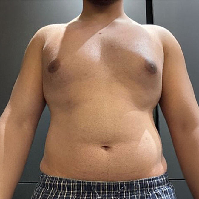 Before transformation