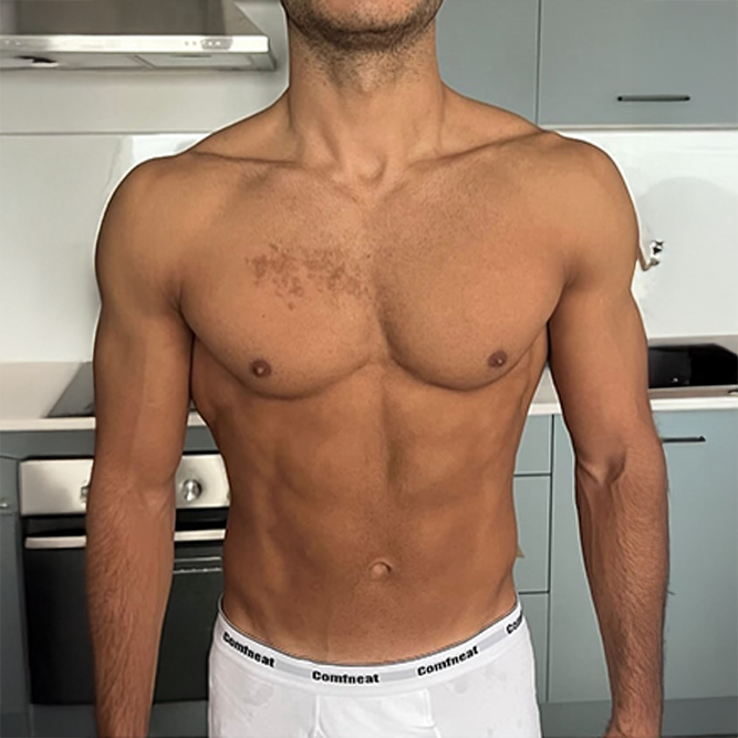 After transformation