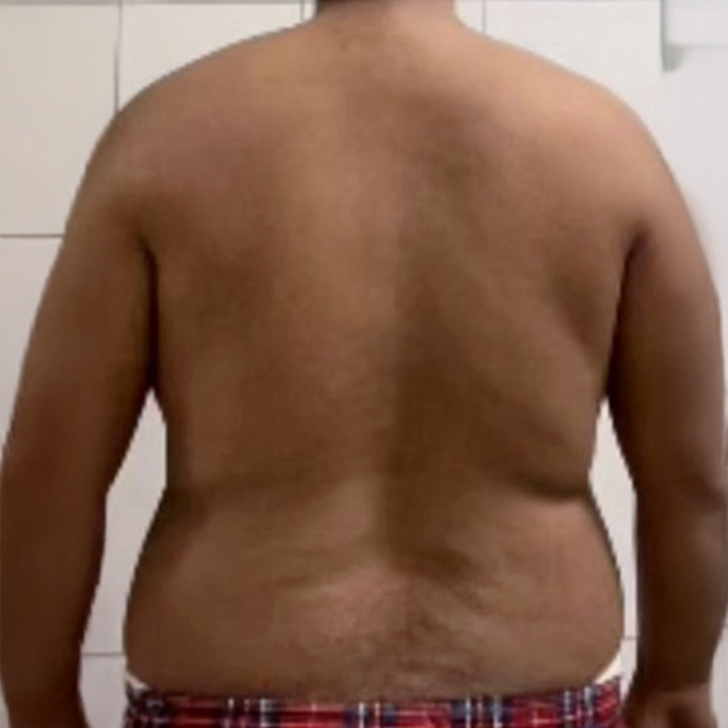 Before transformation